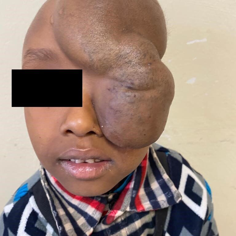Pre-Surgery_1
