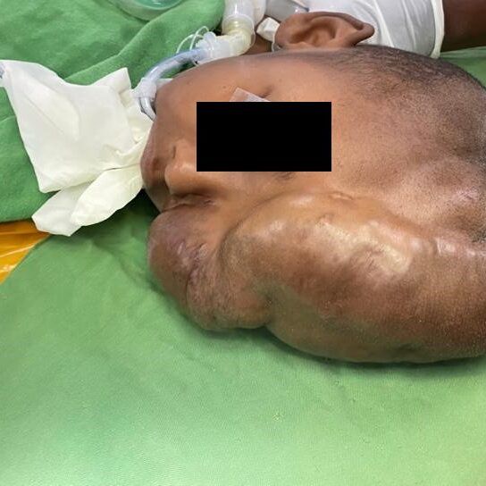 During-Surgery_1